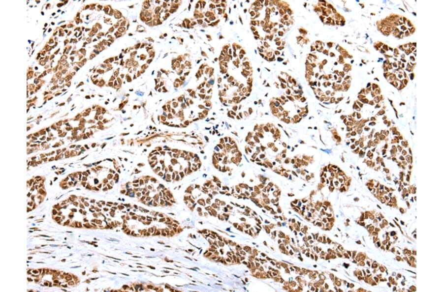 Immunohistochemistry - YY1 Antibody from Signalway Antibody (42865) - Antibodies.com