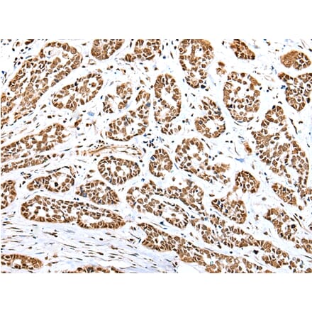 Immunohistochemistry - YY1 Antibody from Signalway Antibody (42865) - Antibodies.com