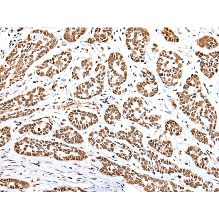 Immunohistochemistry - YY1 Antibody from Signalway Antibody (42865) - Antibodies.com