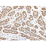 Immunohistochemistry - YY1 Antibody from Signalway Antibody (42865) - Antibodies.com