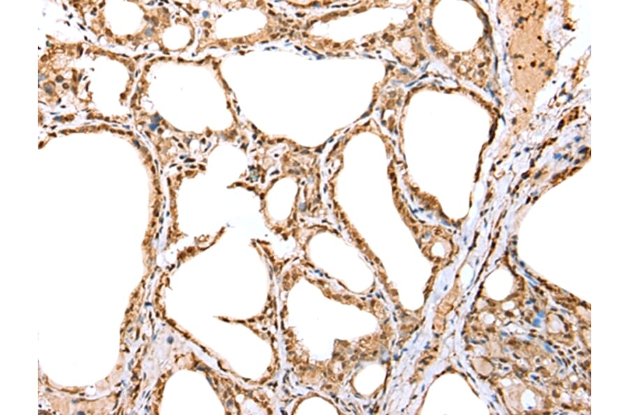 Immunohistochemistry - YY1 Antibody from Signalway Antibody (42865) - Antibodies.com