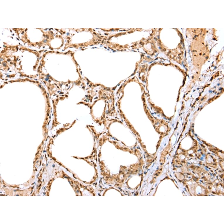 Immunohistochemistry - YY1 Antibody from Signalway Antibody (42865) - Antibodies.com