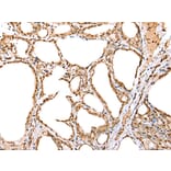 Immunohistochemistry - YY1 Antibody from Signalway Antibody (42865) - Antibodies.com