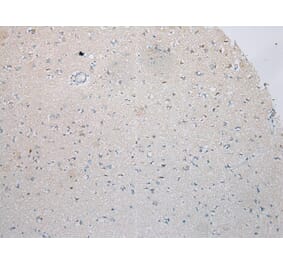 Immunohistochemistry - ICK Antibody from Signalway Antibody (42899) - Antibodies.com