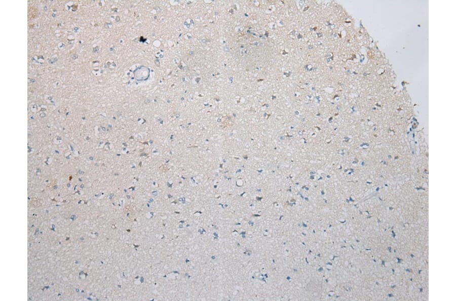 Immunohistochemistry - ICK Antibody from Signalway Antibody (42899) - Antibodies.com