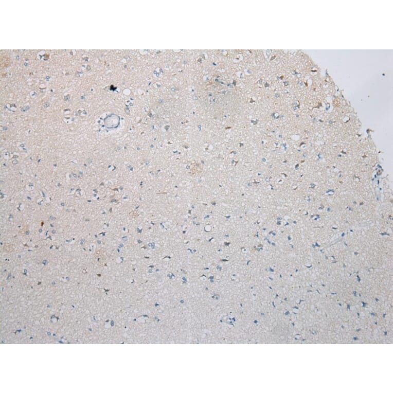 Immunohistochemistry - ICK Antibody from Signalway Antibody (42899) - Antibodies.com
