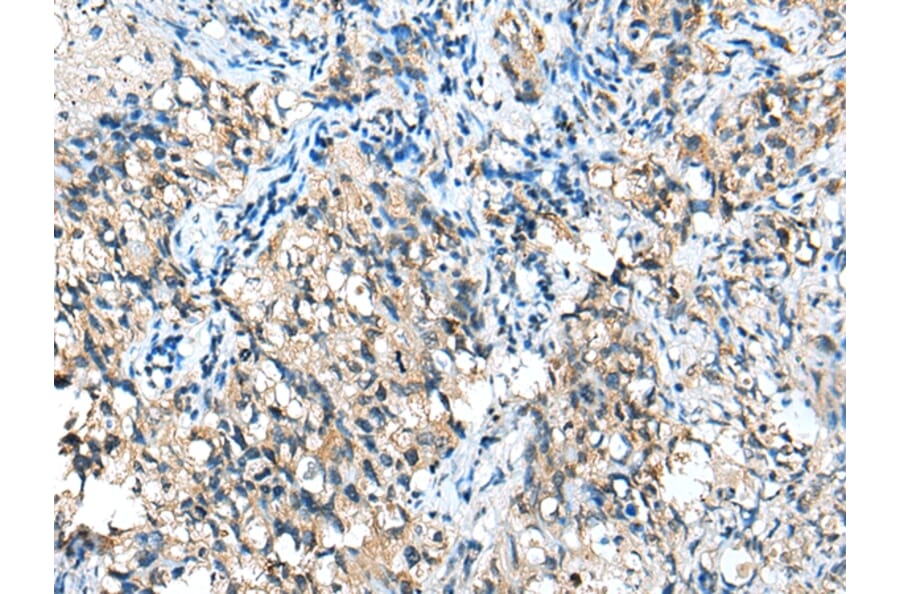 Immunohistochemistry - CFB Antibody from Signalway Antibody (42949) - Antibodies.com