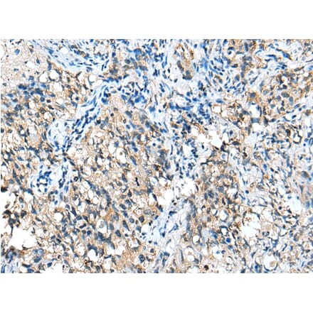 Immunohistochemistry - CFB Antibody from Signalway Antibody (42949) - Antibodies.com