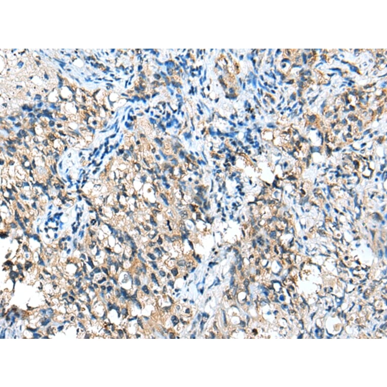 Immunohistochemistry - CFB Antibody from Signalway Antibody (42949) - Antibodies.com
