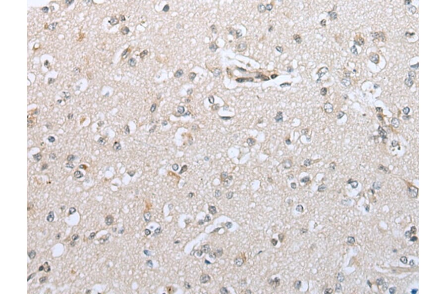 Immunohistochemistry - CFB Antibody from Signalway Antibody (42949) - Antibodies.com