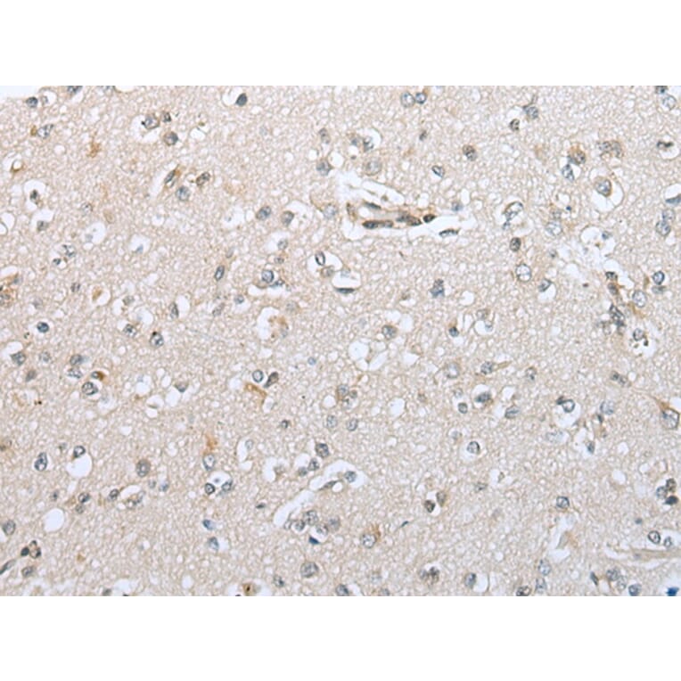 Immunohistochemistry - CFB Antibody from Signalway Antibody (42949) - Antibodies.com