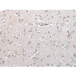 Immunohistochemistry - CFB Antibody from Signalway Antibody (42949) - Antibodies.com