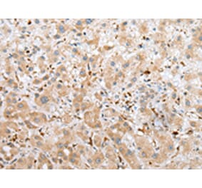 Immunohistochemistry - NPL Antibody from Signalway Antibody (42953) - Antibodies.com