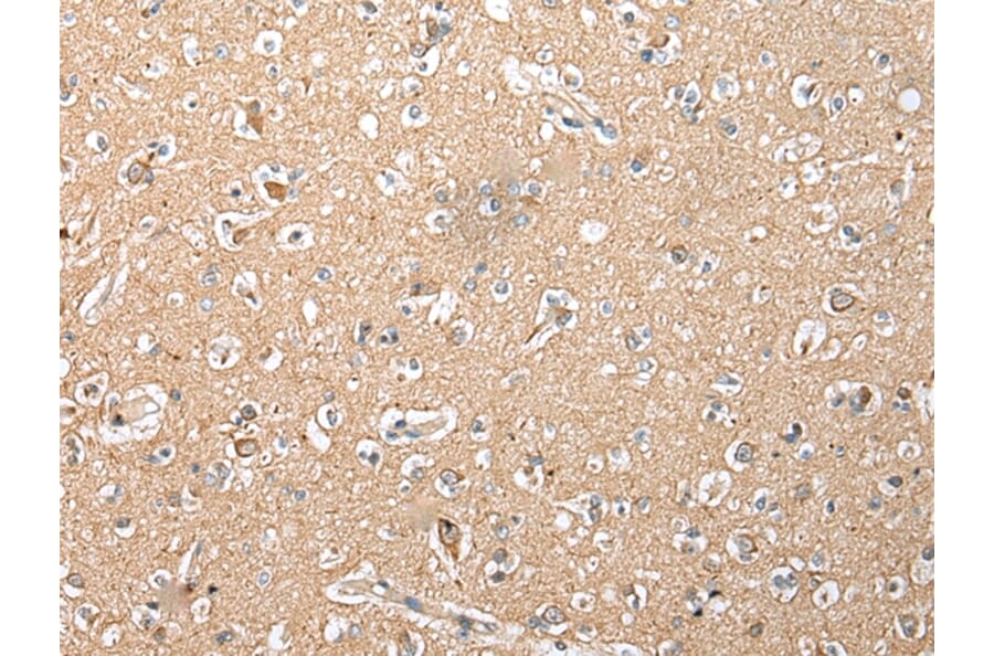 Immunohistochemistry - RFK Antibody from Signalway Antibody (42958) - Antibodies.com