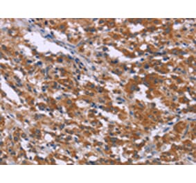 Immunohistochemistry - SKI Antibody from Signalway Antibody (43088) - Antibodies.com