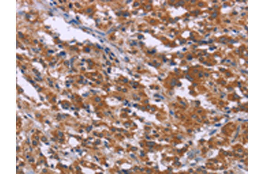 Immunohistochemistry - SKI Antibody from Signalway Antibody (43088) - Antibodies.com