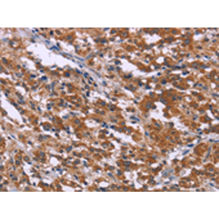 Immunohistochemistry - SKI Antibody from Signalway Antibody (43088) - Antibodies.com