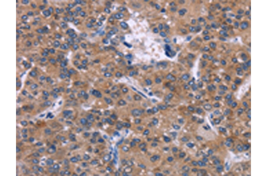 Immunohistochemistry - SKI Antibody from Signalway Antibody (43088) - Antibodies.com