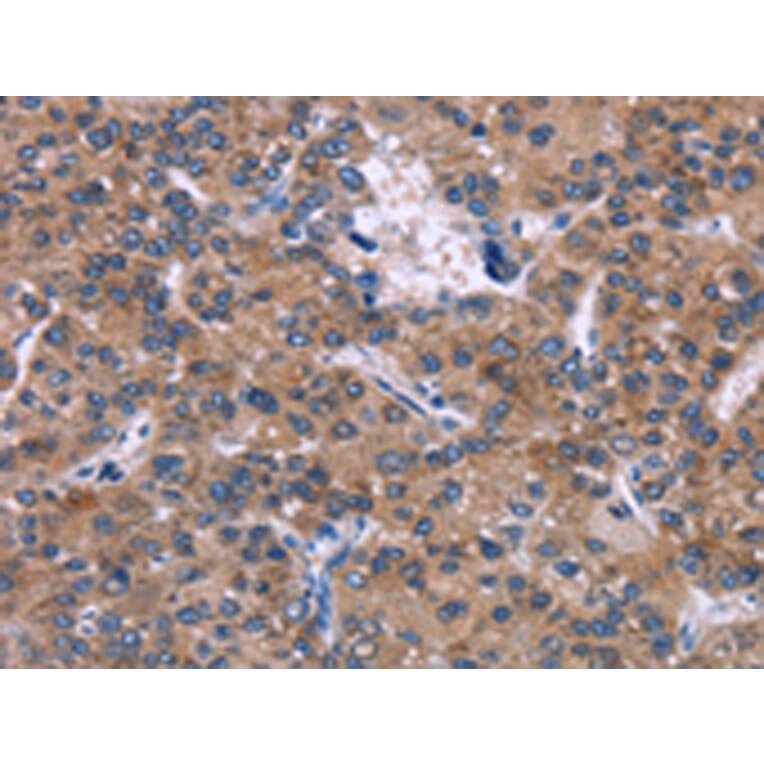 Immunohistochemistry - SKI Antibody from Signalway Antibody (43088) - Antibodies.com