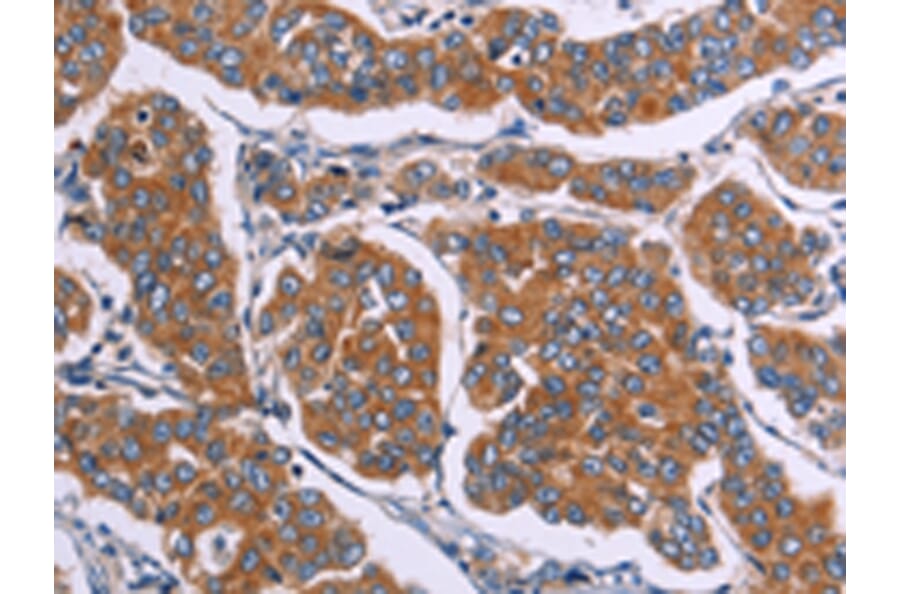Immunohistochemistry - FST Antibody from Signalway Antibody (43091) - Antibodies.com