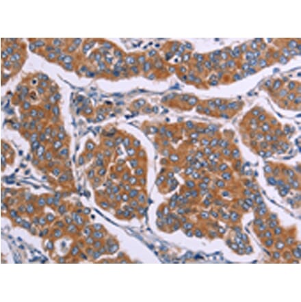 Immunohistochemistry - FST Antibody from Signalway Antibody (43091) - Antibodies.com