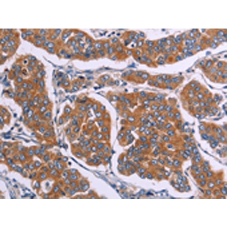 Immunohistochemistry - FST Antibody from Signalway Antibody (43091) - Antibodies.com