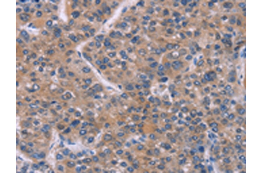 Immunohistochemistry - FST Antibody from Signalway Antibody (43091) - Antibodies.com