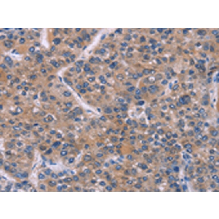 Immunohistochemistry - FST Antibody from Signalway Antibody (43091) - Antibodies.com