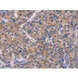 Immunohistochemistry - FST Antibody from Signalway Antibody (43091) - Antibodies.com