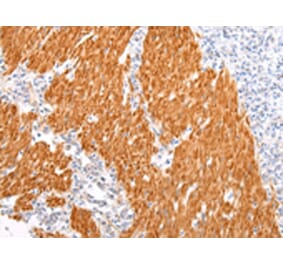 Immunohistochemistry - BSN Antibody from Signalway Antibody (43212) - Antibodies.com