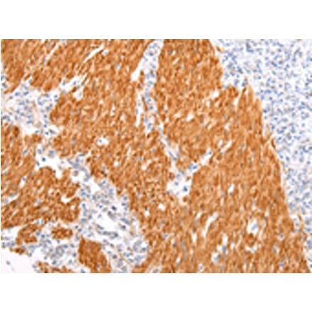 Immunohistochemistry - BSN Antibody from Signalway Antibody (43212) - Antibodies.com