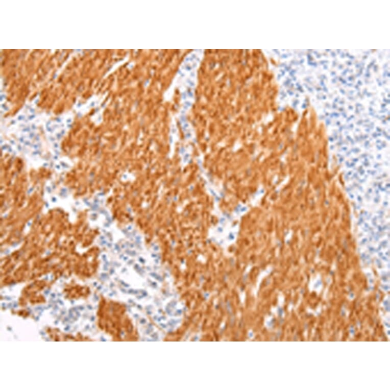 Immunohistochemistry - BSN Antibody from Signalway Antibody (43212) - Antibodies.com