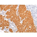 Immunohistochemistry - BSN Antibody from Signalway Antibody (43212) - Antibodies.com