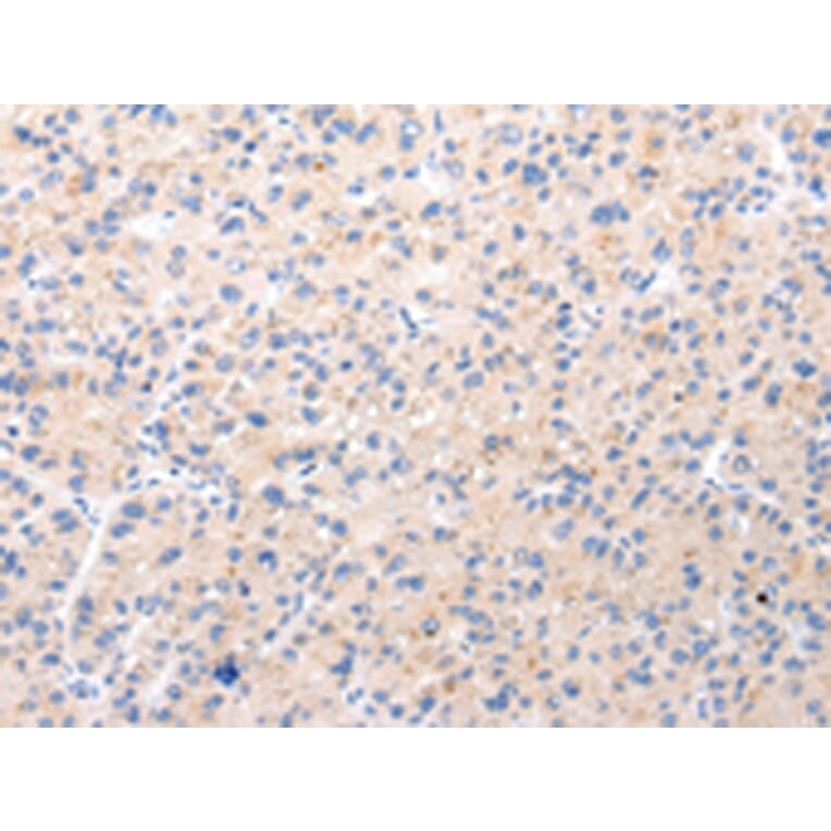 Immunohistochemistry - BSN Antibody from Signalway Antibody (43212) - Antibodies.com