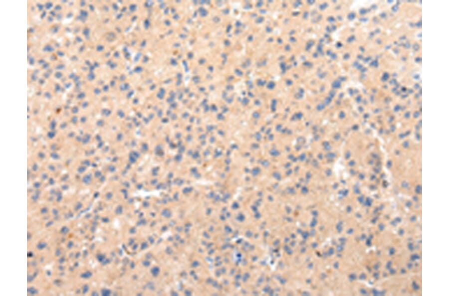 Immunohistochemistry - CLU Antibody from Signalway Antibody (43225) - Antibodies.com