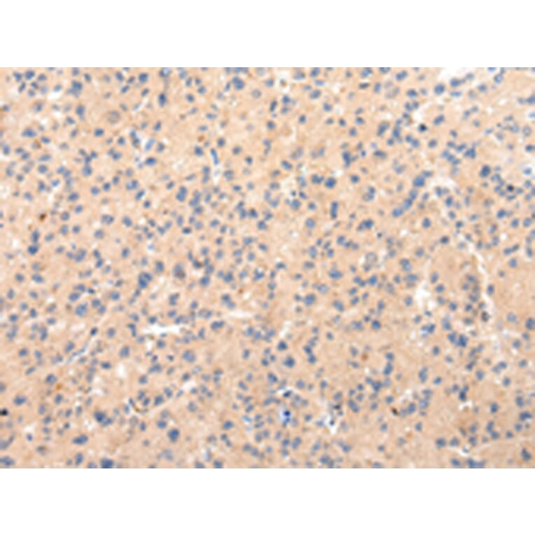 Immunohistochemistry - CLU Antibody from Signalway Antibody (43225) - Antibodies.com