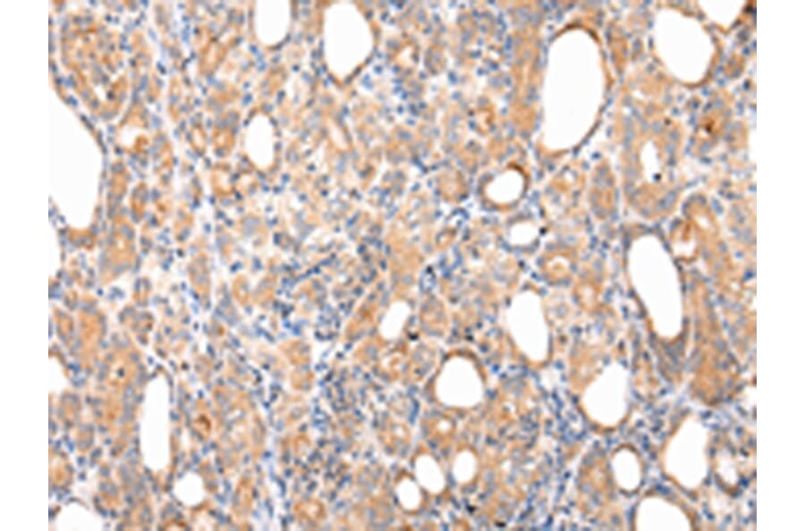 Immunohistochemistry - CLU Antibody from Signalway Antibody (43225) - Antibodies.com