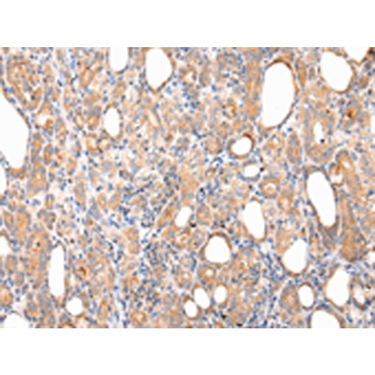 Immunohistochemistry - CLU Antibody from Signalway Antibody (43225) - Antibodies.com