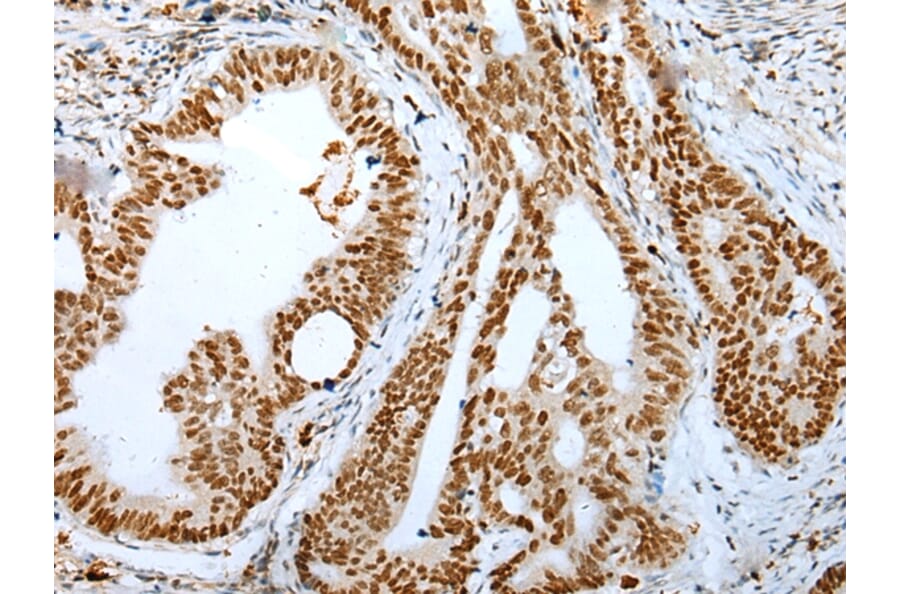 Immunohistochemistry - DEK Antibody from Signalway Antibody (43299) - Antibodies.com