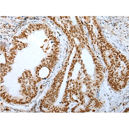Immunohistochemistry - DEK Antibody from Signalway Antibody (43299) - Antibodies.com