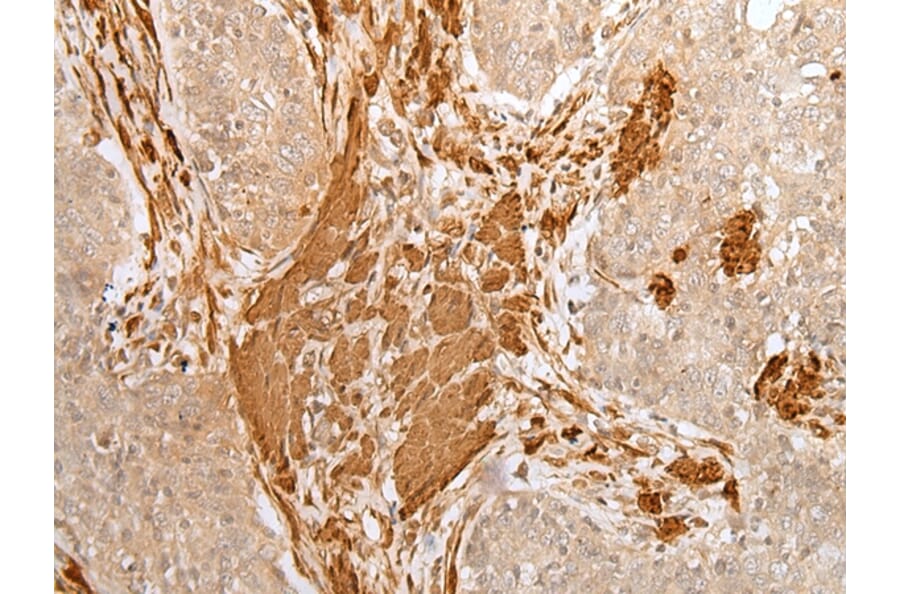 Immunohistochemistry - PF4 Antibody from Signalway Antibody (43300) - Antibodies.com