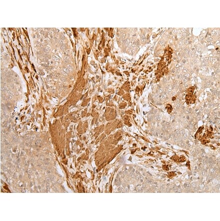 Immunohistochemistry - PF4 Antibody from Signalway Antibody (43300) - Antibodies.com
