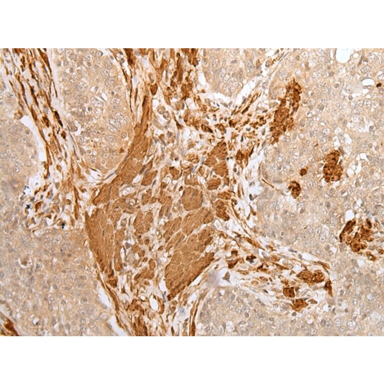 Immunohistochemistry - PF4 Antibody from Signalway Antibody (43300) - Antibodies.com