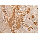 Immunohistochemistry - PF4 Antibody from Signalway Antibody (43300) - Antibodies.com