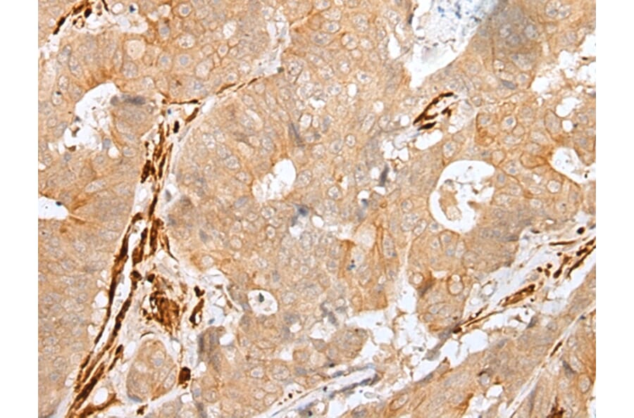 Immunohistochemistry - PF4 Antibody from Signalway Antibody (43300) - Antibodies.com