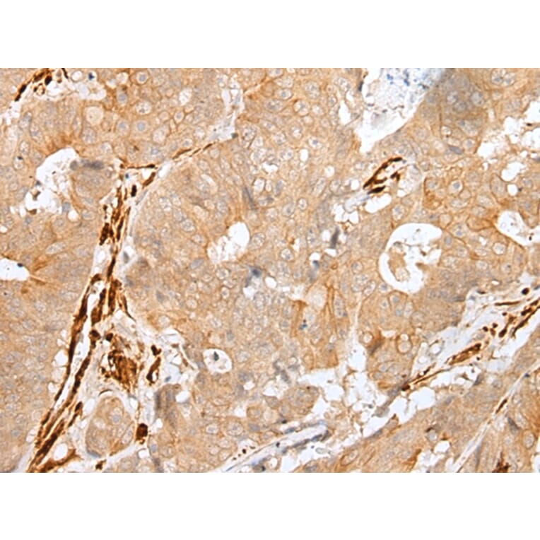 Immunohistochemistry - PF4 Antibody from Signalway Antibody (43300) - Antibodies.com