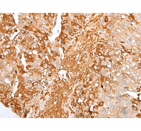 Immunohistochemistry - A2M Antibody from Signalway Antibody (43304) - Antibodies.com