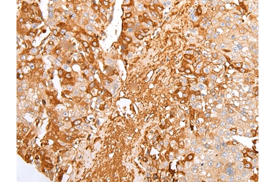 Immunohistochemistry - A2M Antibody from Signalway Antibody (43304) - Antibodies.com