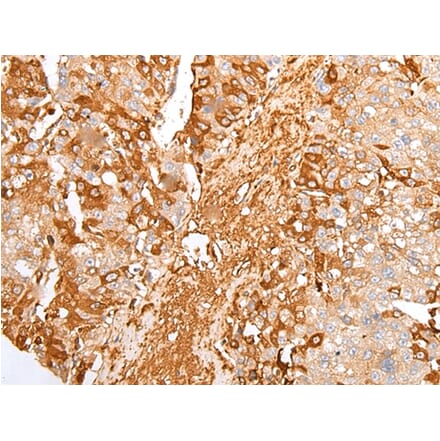 Immunohistochemistry - A2M Antibody from Signalway Antibody (43304) - Antibodies.com
