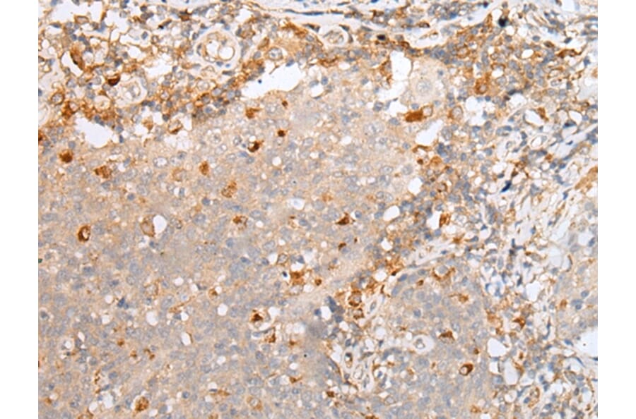 Immunohistochemistry - A2M Antibody from Signalway Antibody (43304) - Antibodies.com